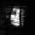 White Mist - The Pineapple Thief