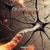 Brain Damage - Alejandro Dario