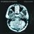 Lights Out - Breaking Benjamin