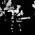 Poison Tree (instrumental loop slowed) - Grouper